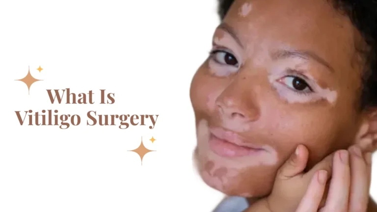 Graphic titled What Is Vitiligo Surgery, showing depigmented vitiligo patches on skin
