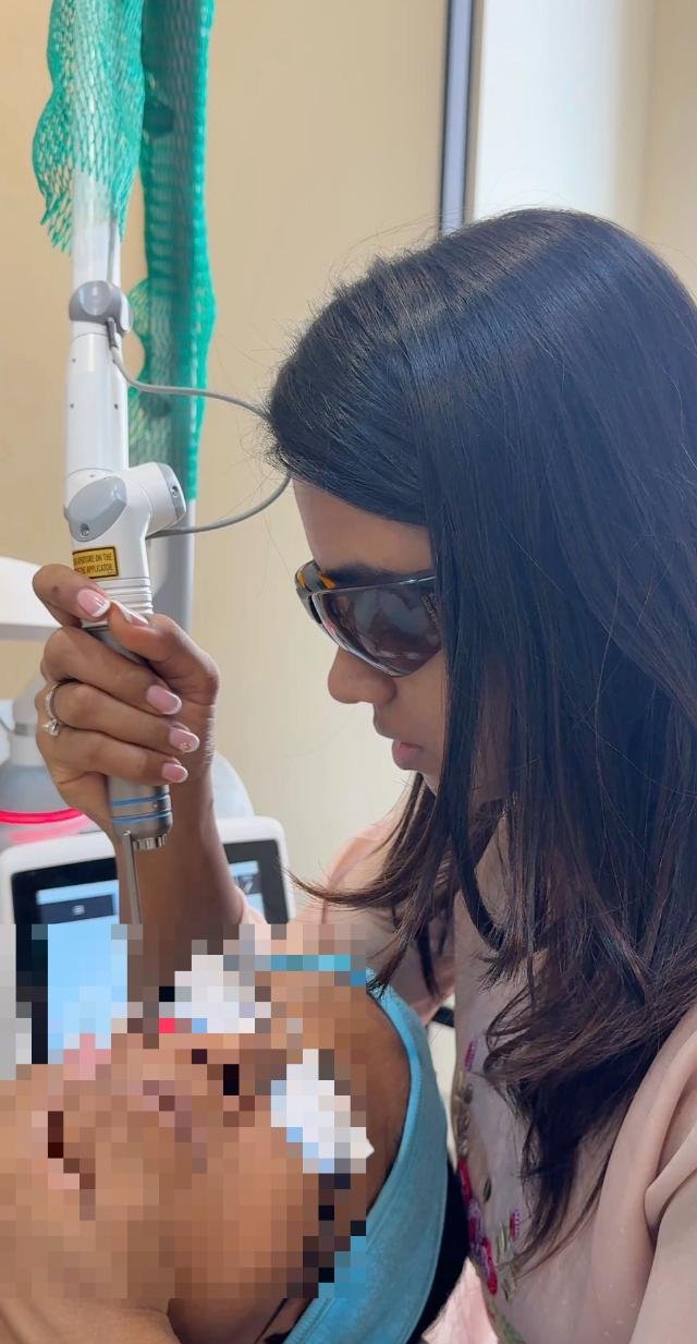 Dr. Praneeta Jain performing fractional CO2 laser resurfacing for acne scars