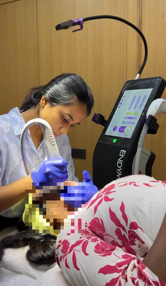 Dr. Praneeta Jain performing microneedling radiofrequency on the EndyMed Pro Max