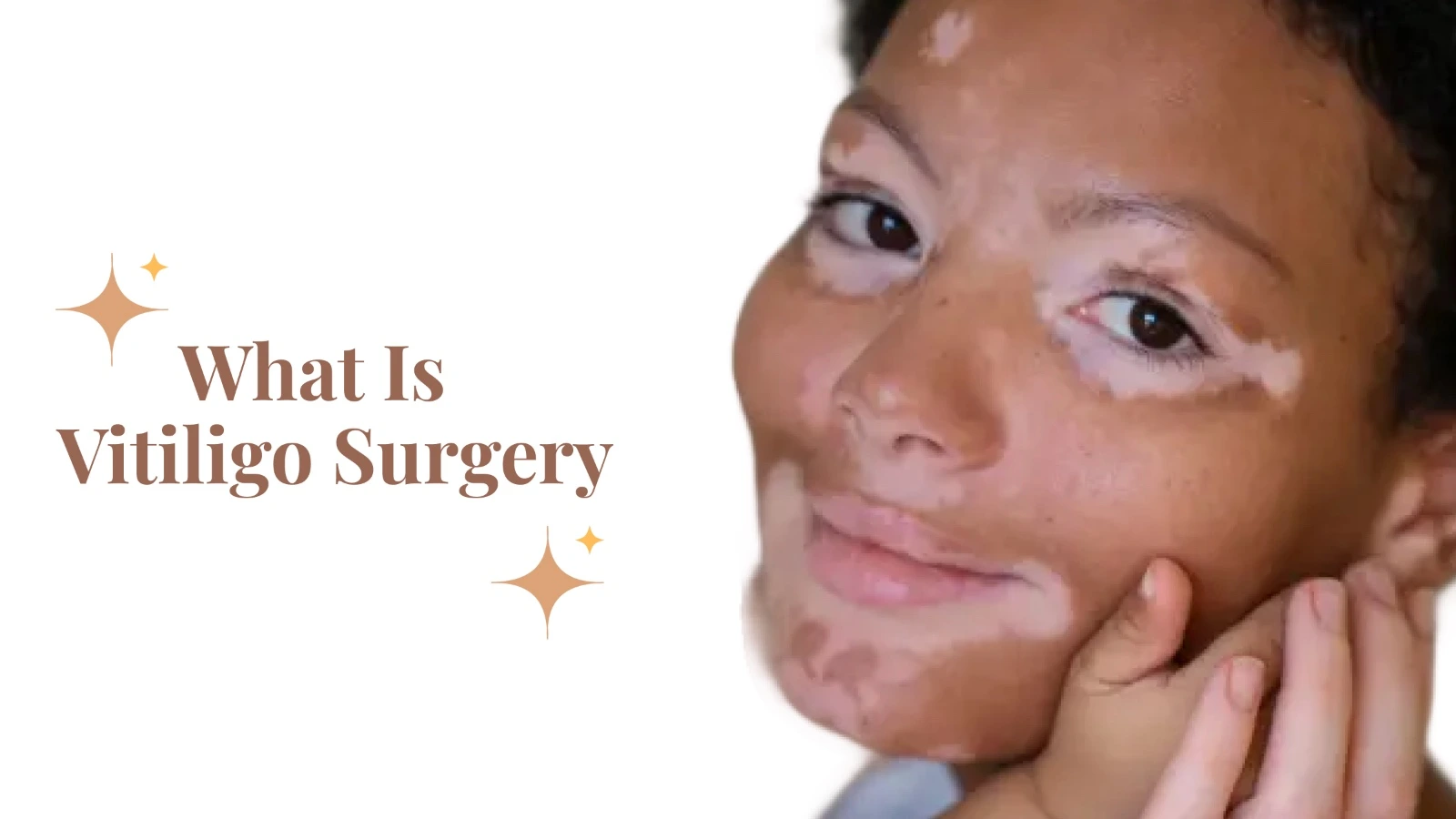 What Is Vitiligo Surgery