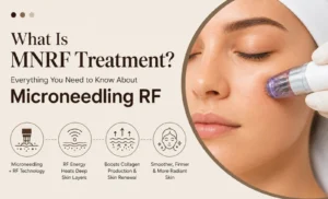What Is MNRF Treatment? Everything You Need to Know About Microneedling RF